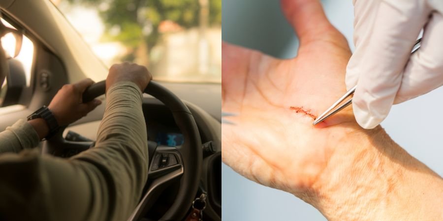 Wann Autofahren Nach Hand Op